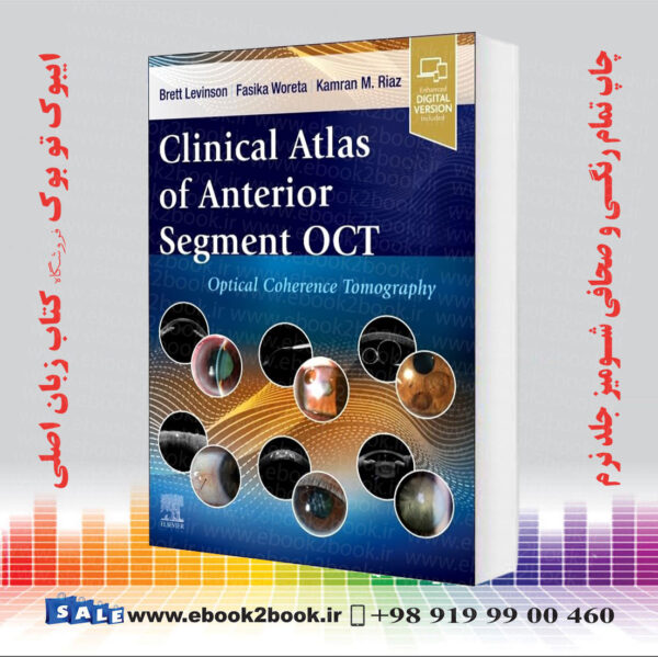 کتاب Clinical Atlas Of Anterior Segment Oct: Optical Coherence Tomography