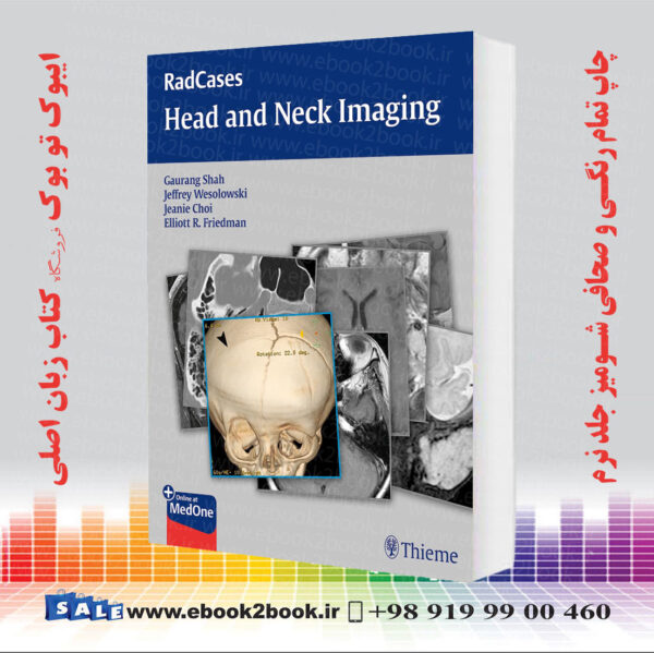 کتاب Radcases Head And Neck Imaging