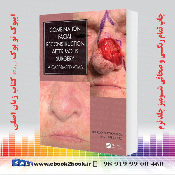 کتاب Combination Facial Reconstruction After Mohs Surgery