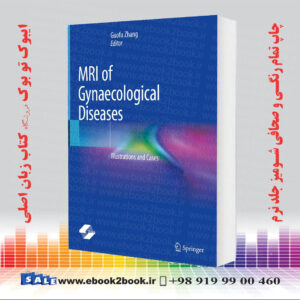 کتاب MRI of Gynaecological Diseases: Illustrations and Cases