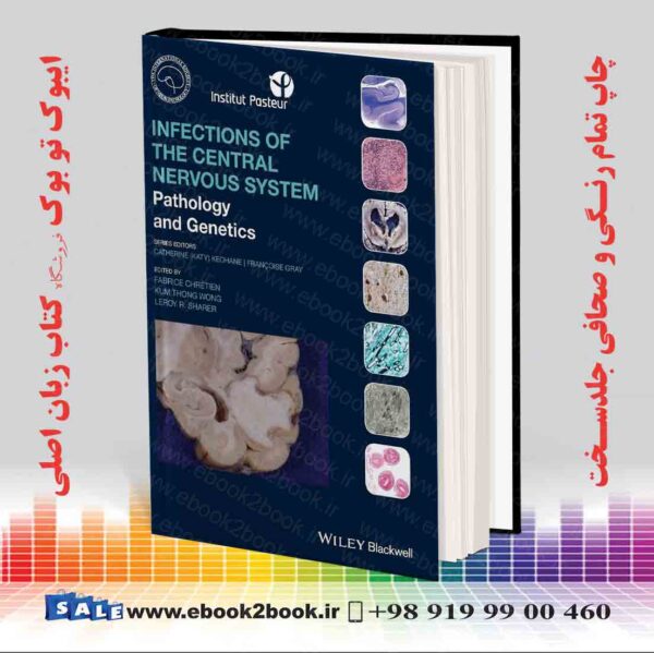 کتاب Infections Of The Central Nervous System: Pathology And Genetics