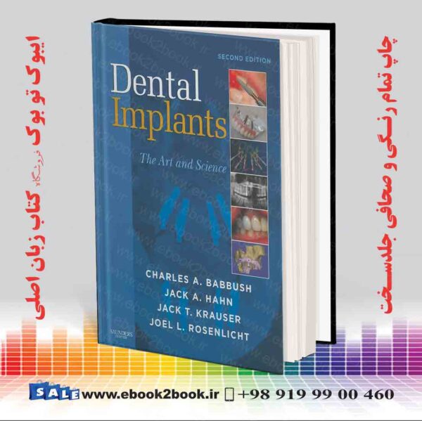 کتاب Dental Implants: The Art And Science 2Nd Edition