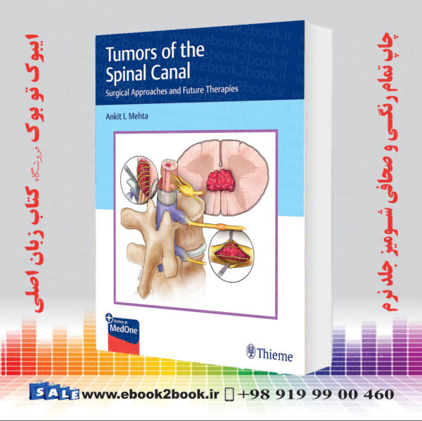 کتاب Tumors Of The Spinal Canal: Surgical Approaches And Future Therapies