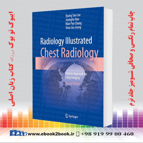 کتاب Radiology Illustrated: Chest Radiology: Pattern Approach For Lung Imaging Second Edition