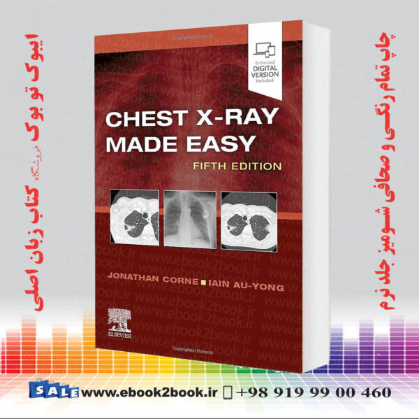 کتاب Chest X-Ray Made Easy 5Th Edition